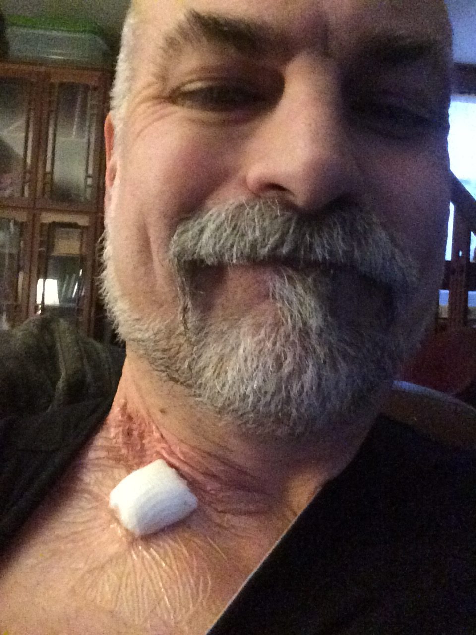 That's a little cotton pad and a big sheet of plastic stuck to my neck.  Over a HOLE THEY PUNCHED IN ME.  I'm not complaining.  Old style surgery involved scars and ^%&$.